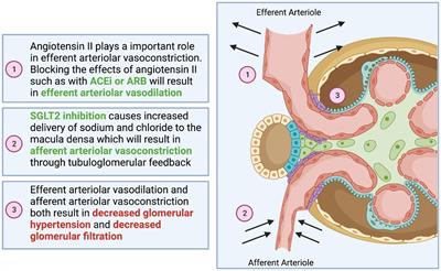 Treatment and practical considerations of diabetic kidney disease